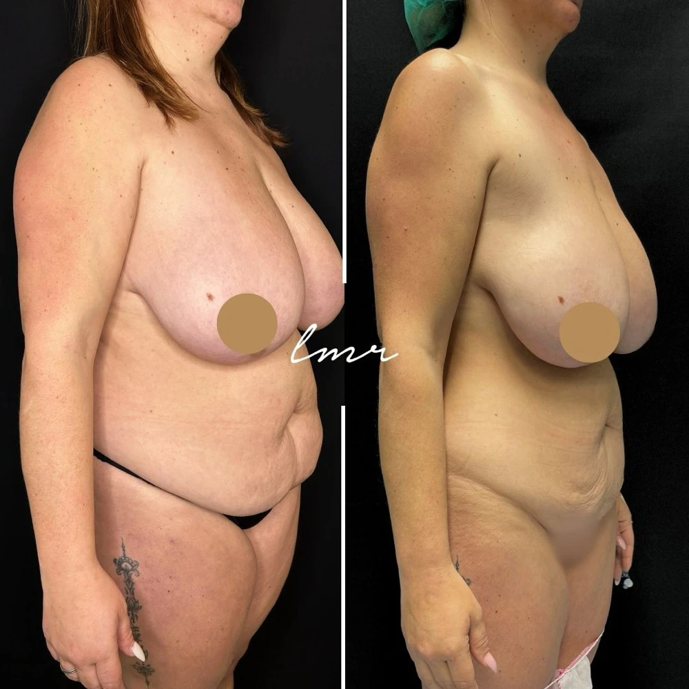 Clinical Case #36520-1