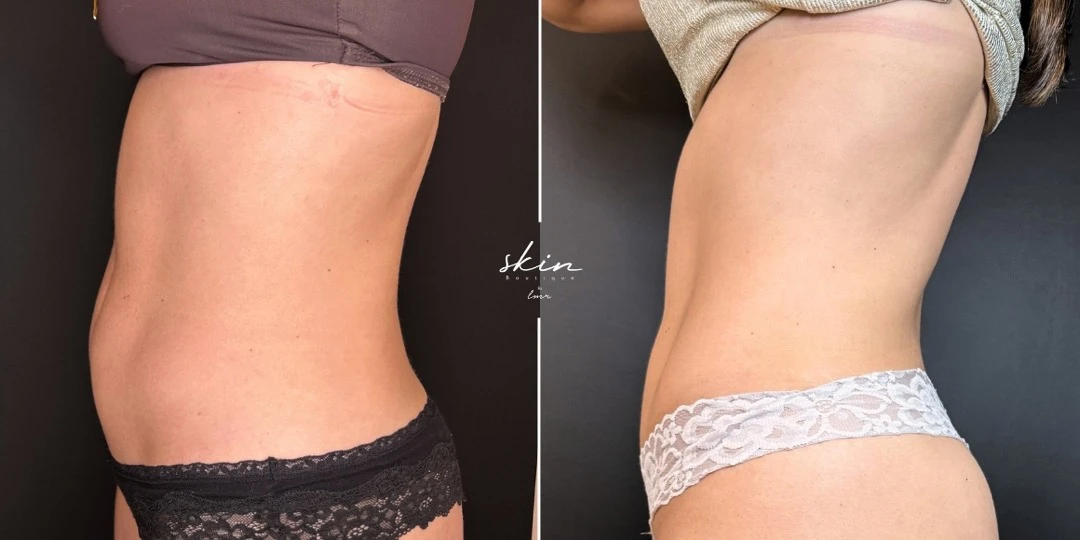 Caso clínico #30160