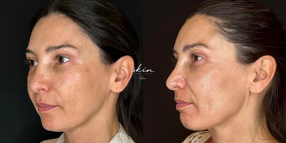 Clinical Case #520634