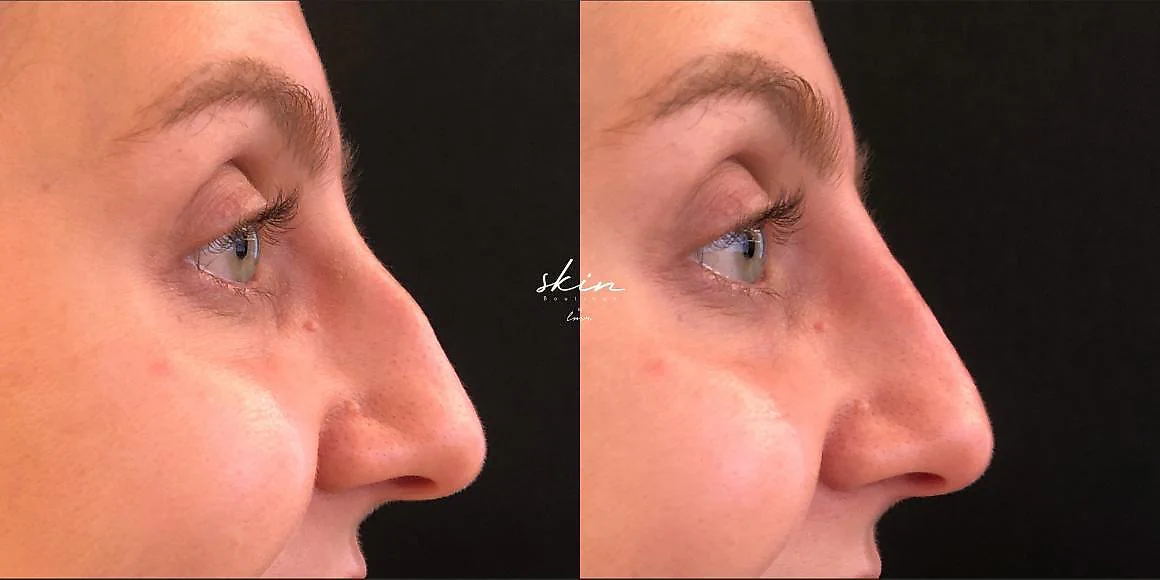 Clinical Case #520631